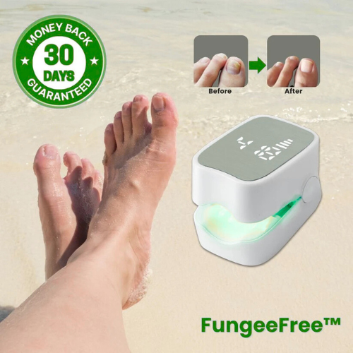 Growvy™ - Nail Fungus Laser