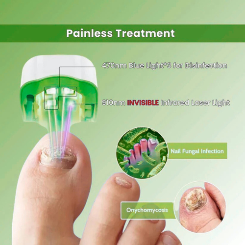 Growvy™ - Nail Fungus Laser