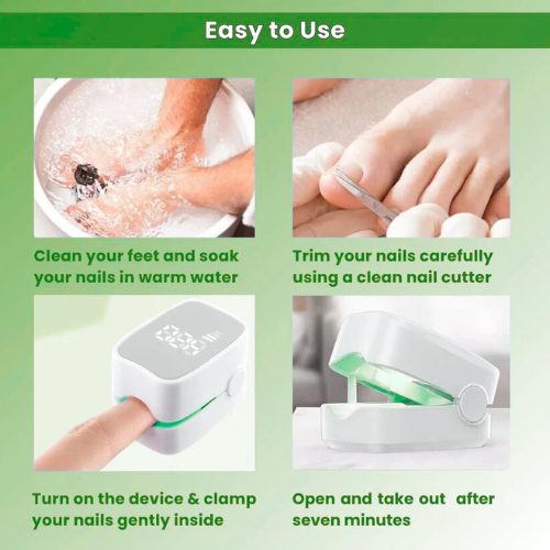 Growvy™ - Nail Fungus Laser