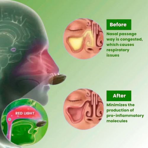 GrowvyComfyNas™ - Comfortable Nasal Solution